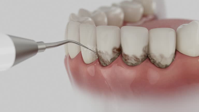 Reliable Tooth Extraction contractor in Bibb County County, GA by Dentist Open Now